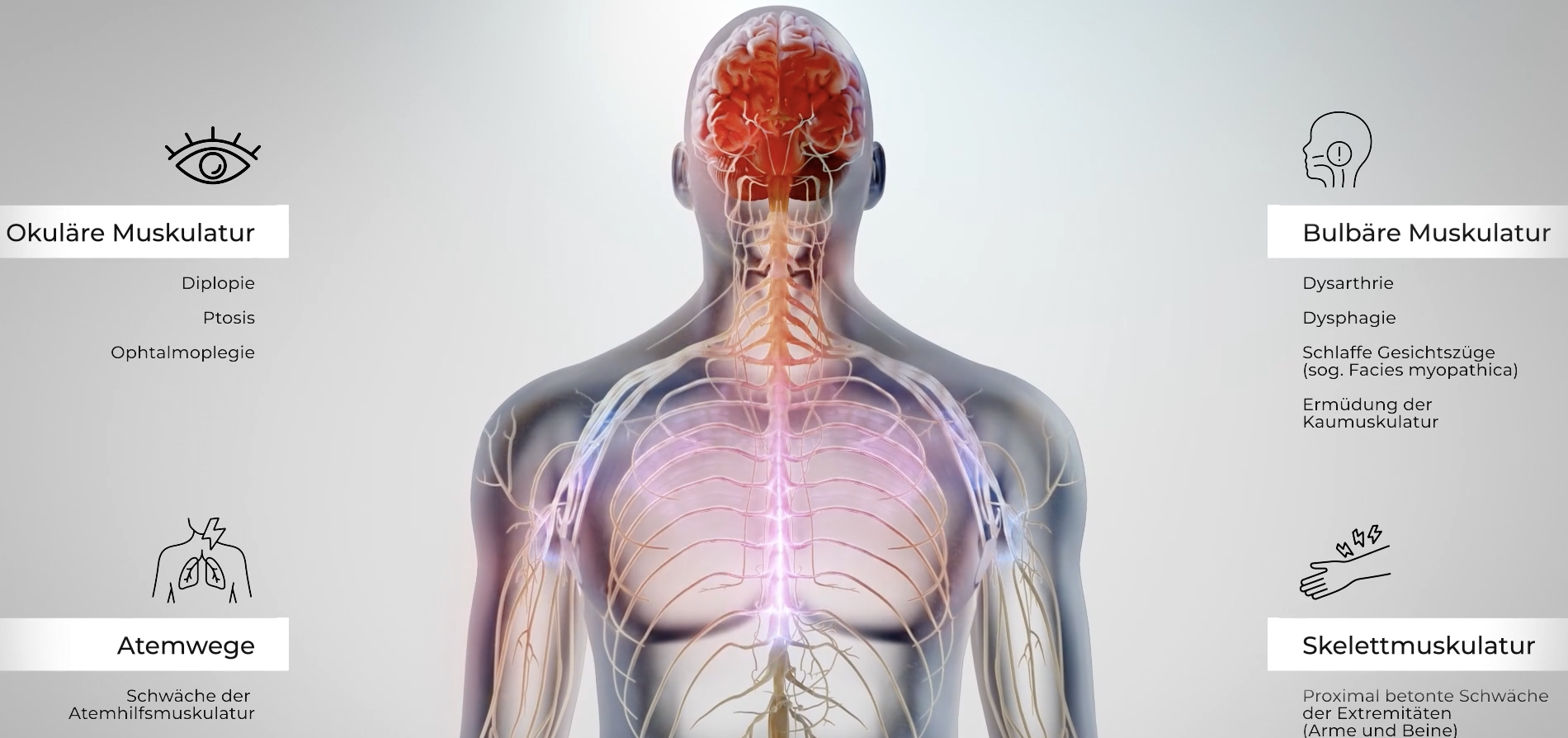 Myasthenia Gravis 